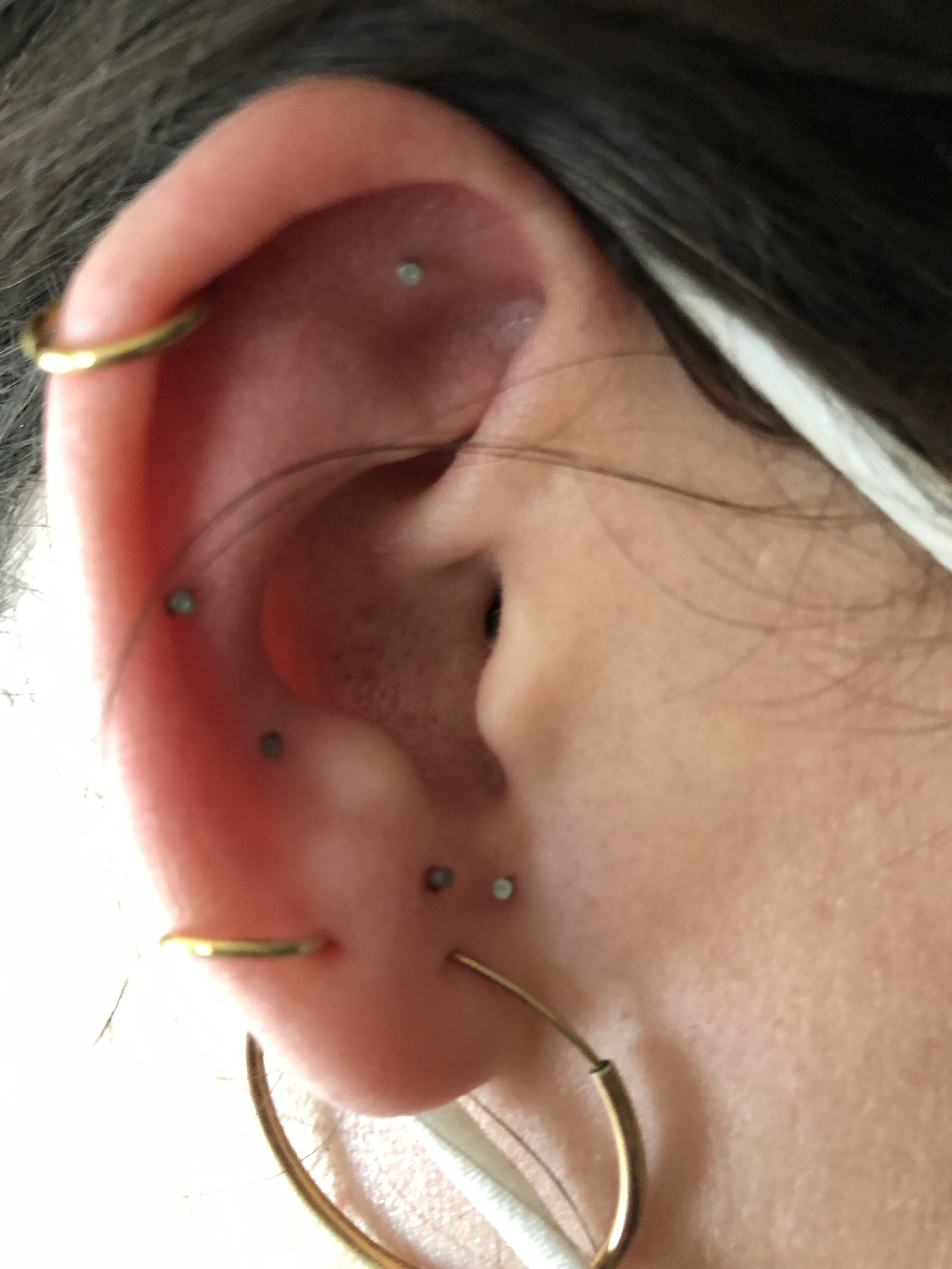 oreilles auriculothérapie